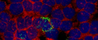 In groen opgelicht, Chlamydia-bacterien.