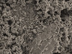2_electroactive bacteria_1000.jpg 2_electroactive bacteria_1000.jpg