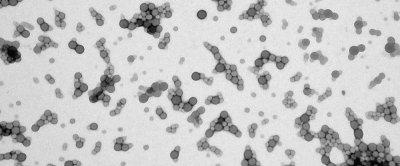 Nanoplastics zijn 1000 keer zo klein als een algencel.