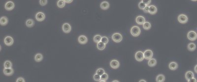 Bakkergist (Saccharomyces cerevisiae) onder de microscoop